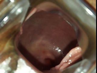 verbreitung ihrer fotze nahaufnahme und spekulum spielen